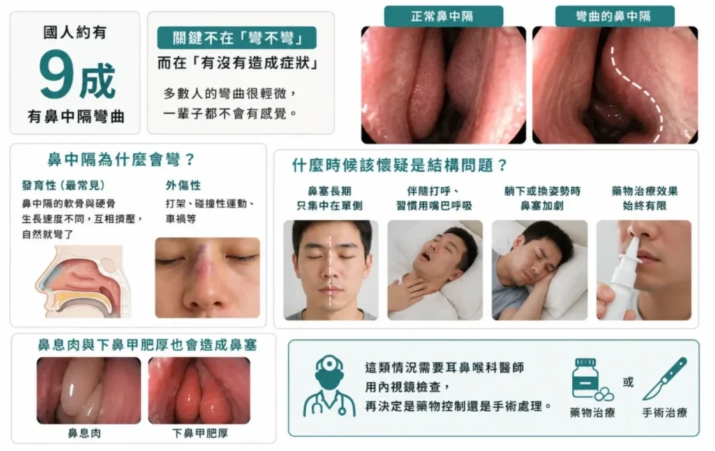 鼻腔結構問題解析圖